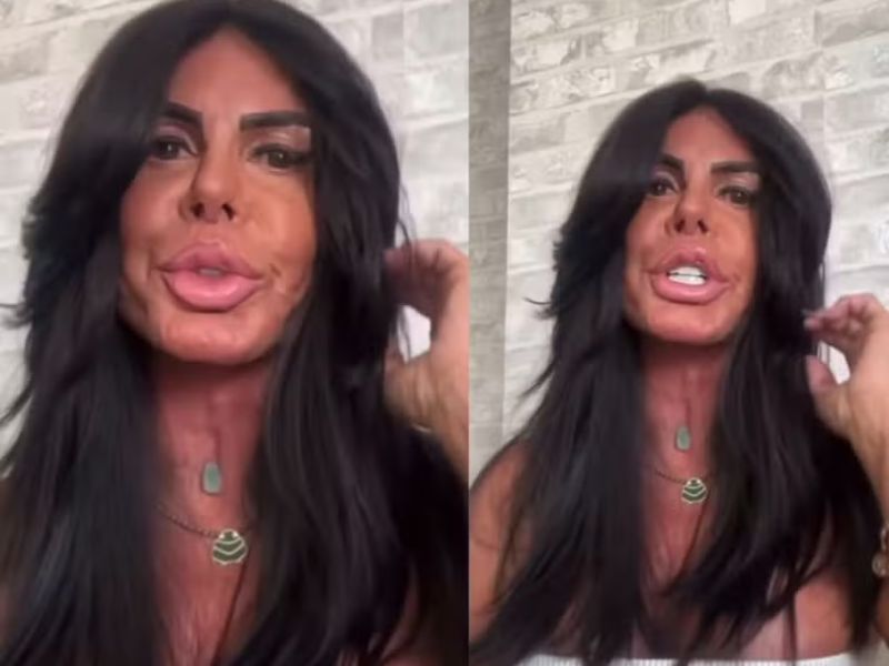 Gretchen faz nova harmonização e mostra rosto sem filtro: 'Fininho'